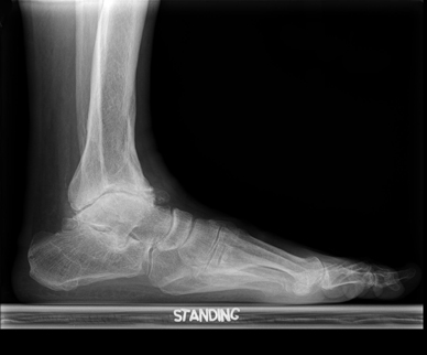 Lateral radiograph prior to treatment